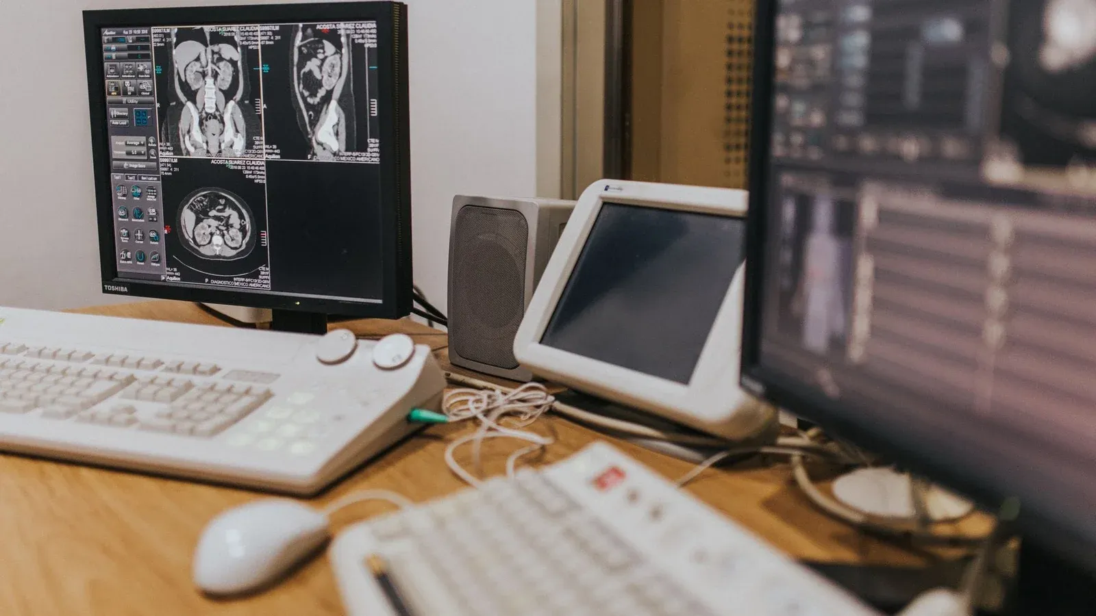 Medical imaging setup with MRI scans on multiple screens in a healthcare facility.
