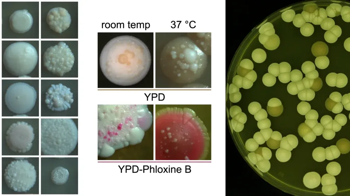 Colonies of different strains on YP-glycerol agar for 14 days at 37°C (left).