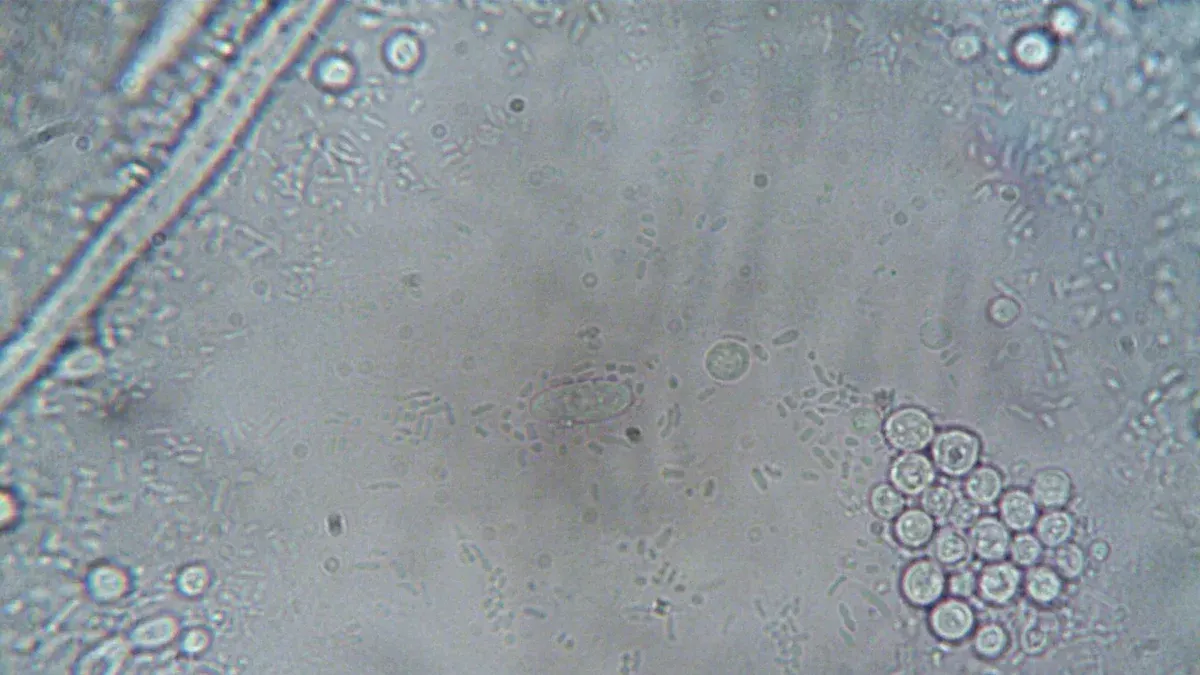 Imagen de microscopio de alta resolución que muestra varias estructuras y organismos celulares.