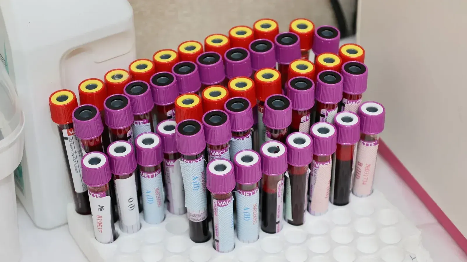 Filas de viales de sangre en un laboratorio, listos para el análisis.