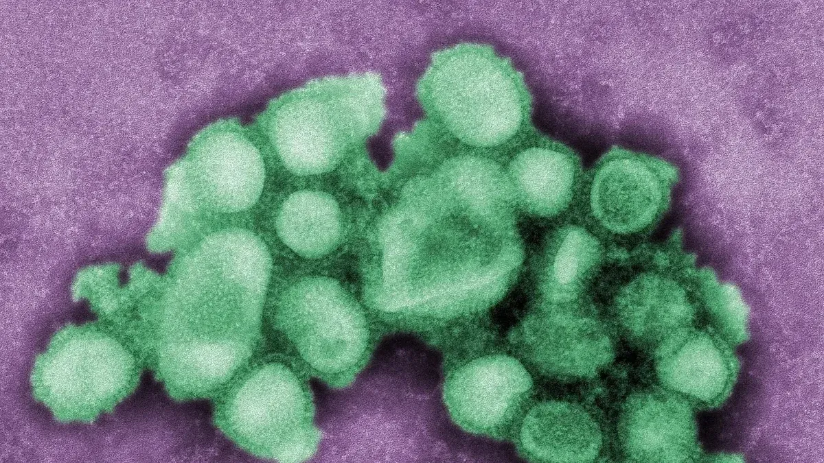 This colorized negative stained transmission electron micrograph (TEM) depicted some of the ultrastructural morphology of the A/CA/4/09 swine flu virus.
