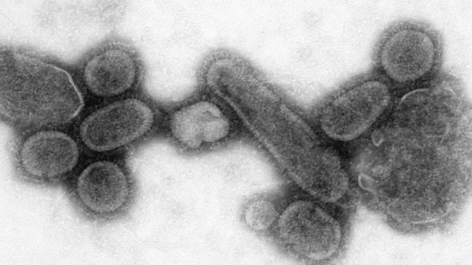 This negative stained transmission electron micrograph (TEM) showed recreated 1918 influenza virions that were collected from the supernatant of a 1918-infected Madin-Darby Canine Kidney