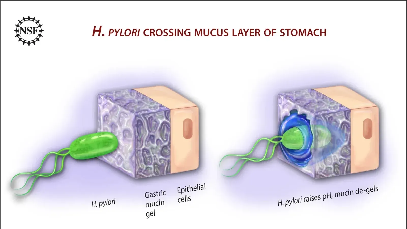 A team of researchers from Boston University, Harvard Medical School and Massachusetts Institute of Technology have shown that the bacterium that causes human stomach ulcers uses a clever