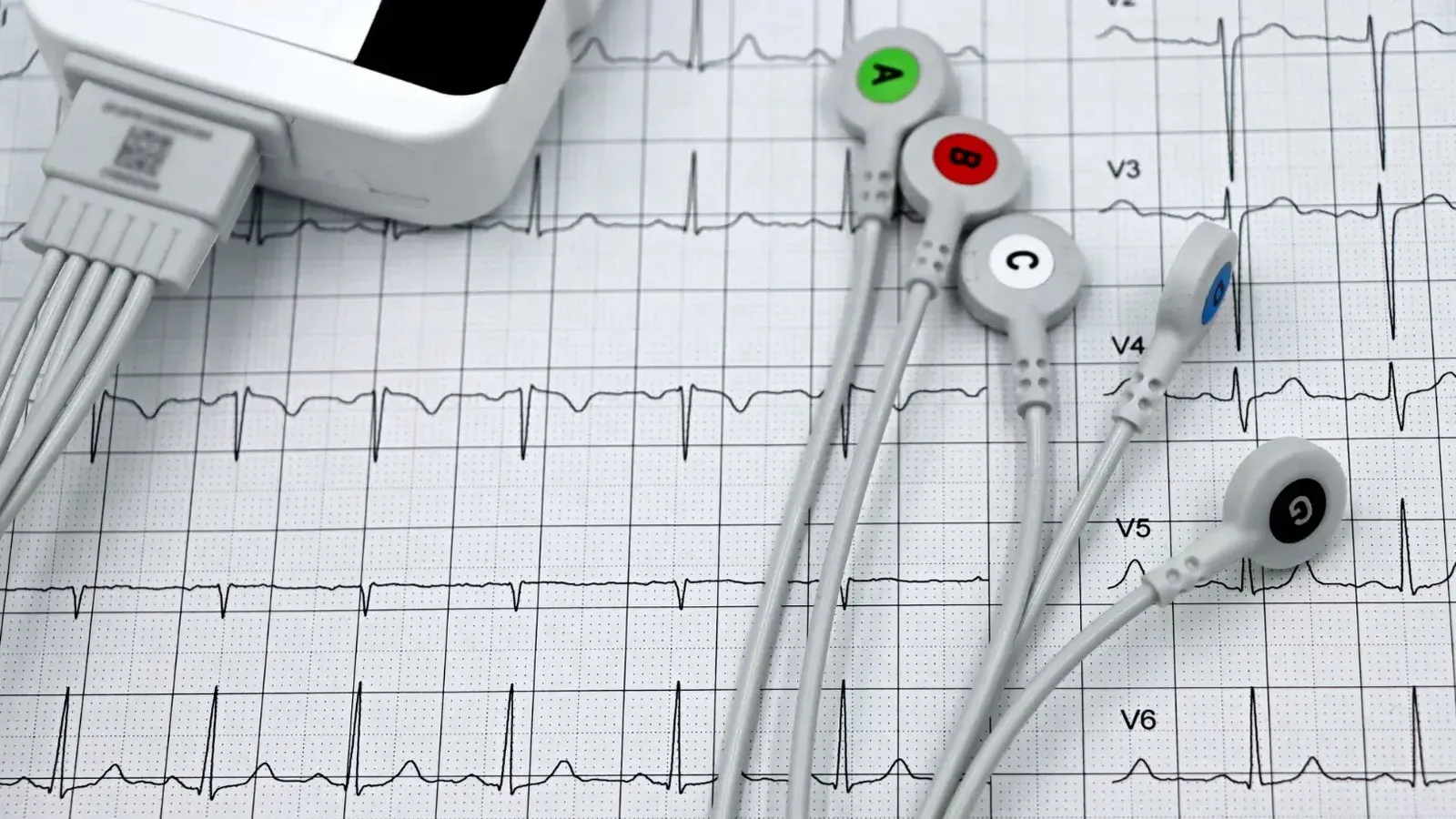 Close-up de ECG Monitor lleva en un cardiograma impreso, que muestra los diagnósticos de salud del corazón.