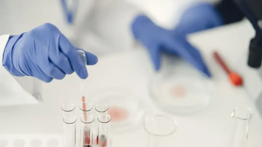 Detectan autoanticuerpos contra proteínas de reparación del ADN en niños con cáncer imagen del post
