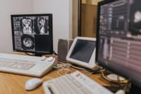 Medical imaging setup with MRI scans on multiple screens in a healthcare facility.
