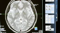 Intricate MRI brain scan displayed on a computer screen for medical analysis and diagnosis.