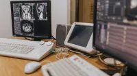 Medical imaging setup with MRI scans on multiple screens in a healthcare facility.