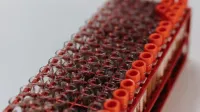 A detailed view of lab test tubes in a rack, perfect for research visuals.