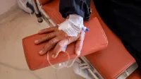 Close-up of a patient's hand receiving chemotherapy treatment in a medical facility.