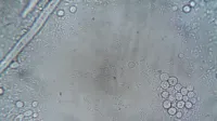 Imagen de microscopio de alta resolución que muestra varias estructuras y organismos celulares.