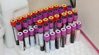 Filas de viales de sangre en un laboratorio, listos para el análisis.