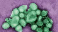This colorized negative stained transmission electron micrograph (TEM) depicted some of the ultrastructural morphology of the A/CA/4/09 swine flu virus.