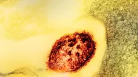 Micrografía electrónica de transmisión coloreada de una partícula del virus del sarampión (rojo).
