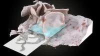 Título: Superficie del microfago infectado por el VIH Descripción: Representación 3D de la superficie y el interior de un macrófago infectado por el VIH obtenido utilizando herramientas