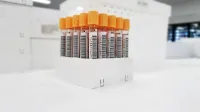 Tubos de ensayo de muestras de sangre con códigos de barras organizados en un laboratorio.