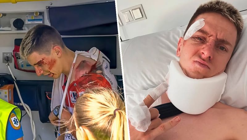 Tremenda caída de Tadej Pogacar en La Vuelta: El compañero de Isaac del Toro será operado por el médico de Moto GP imagen del post