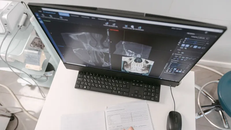 Radiologist analyzing X-ray scans on a computer monitor while taking notes. Medical documents visible.