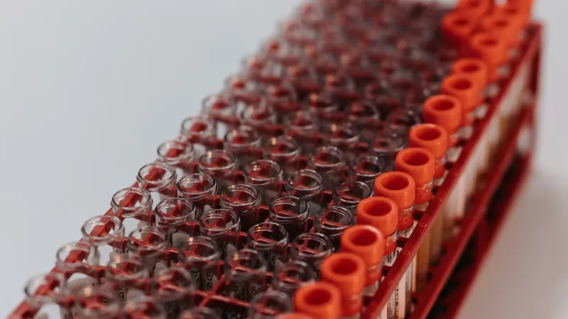 A detailed view of lab test tubes in a rack, perfect for research visuals.