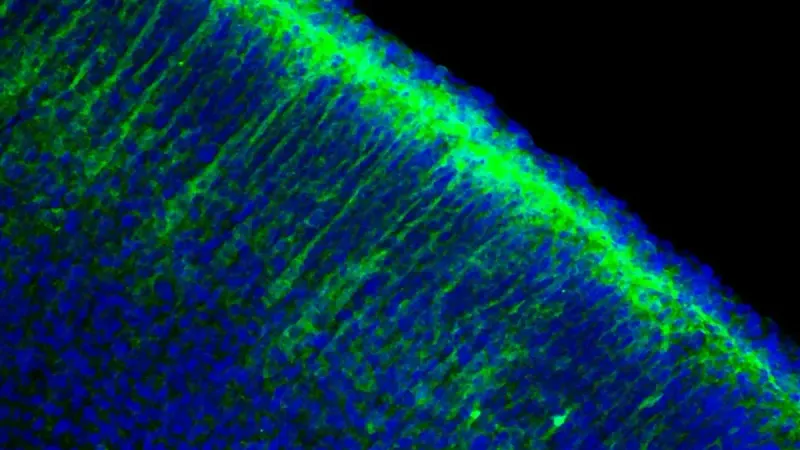 Los investigadores de Washu Medicine han demostrado en ratones que el crecimiento lento del cerebro en el síndrome de Angelman es causado por niveles elevados de una molécula llamada