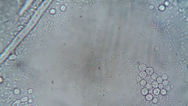 Imagen de microscopio de alta resolución que muestra varias estructuras y organismos celulares.