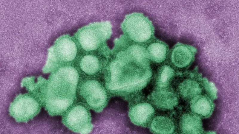This colorized negative stained transmission electron micrograph (TEM) depicted some of the ultrastructural morphology of the A/CA/4/09 swine flu virus.