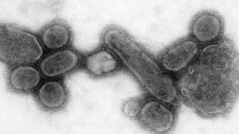 This negative stained transmission electron micrograph (TEM) showed recreated 1918 influenza virions that were collected from the supernatant of a 1918-infected Madin-Darby Canine Kidney