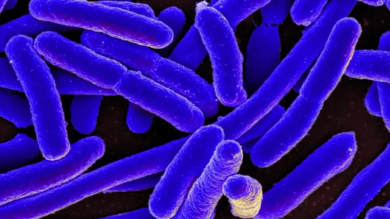 Colorized scanning electron micrograph of Escherichia coli, grown in culture and adhered to a cover slip.