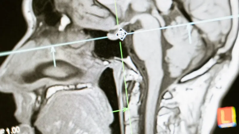 Close-up of an MRI scan showing a sagittal view of the human brain for analysis.